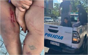 mujer_heridas1