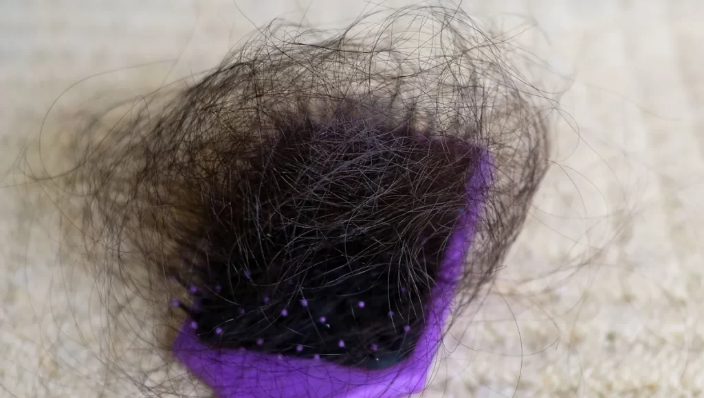 caida-pelo