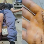 Atacaron con un cuchillo a un policía, tras un operativo por robo de cables